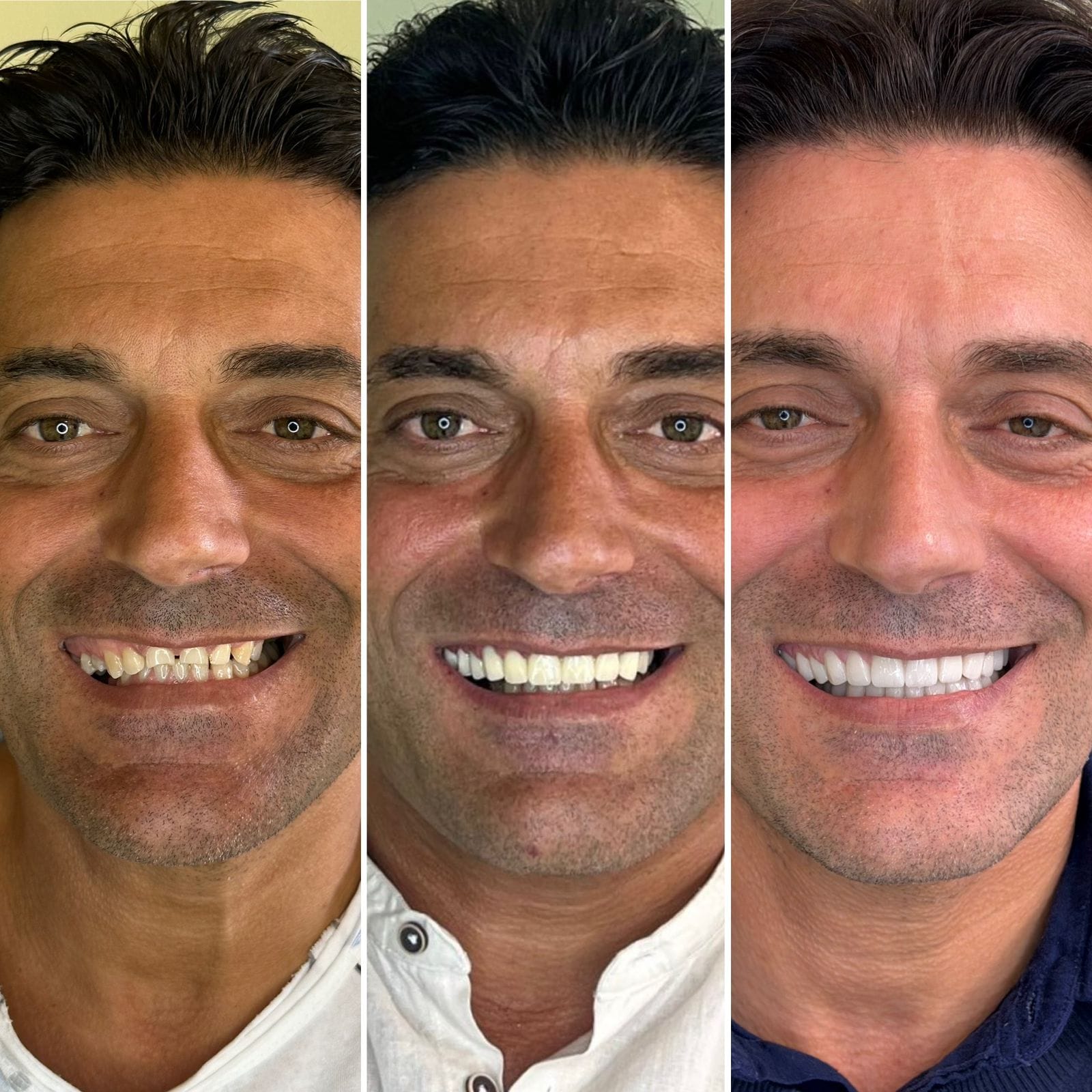 Dental Tourism Albania