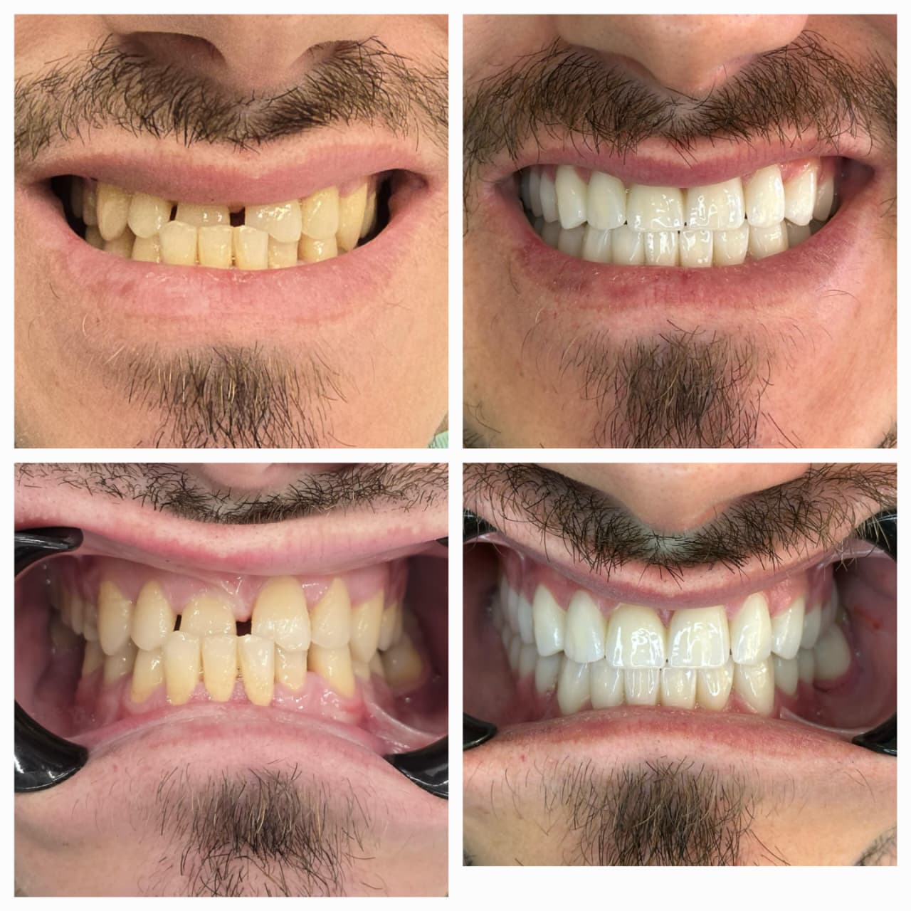 Dental Tourism Albania